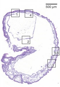 This structure has many characteristics like an embryo, but it started as a mass of in vivo-produced stem cells injected into abdomical cavity of a normal mouse.  from Abad et al.